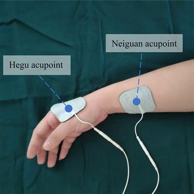 Transcutaneous Electrical Acupoint Stimulation Improved Preoperative Blood Pressure in Gynecological Malignant Tumor Patients With Hypertension: A Randomized, Controlled Trial